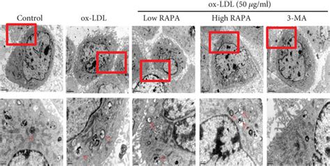 Typical Features Of Autophagy Induced By Rapamycin In Vsmcs A Download Scientific Diagram