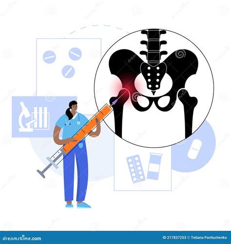Hip joint injection stock vector. Illustration of pelvis - 217837253
