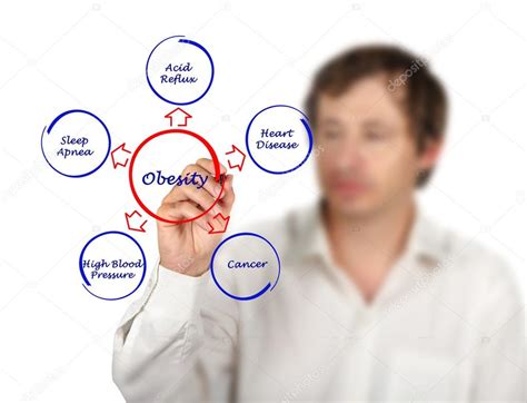 Diagram of obesity Stock Photo by ©vaeenma 43038149