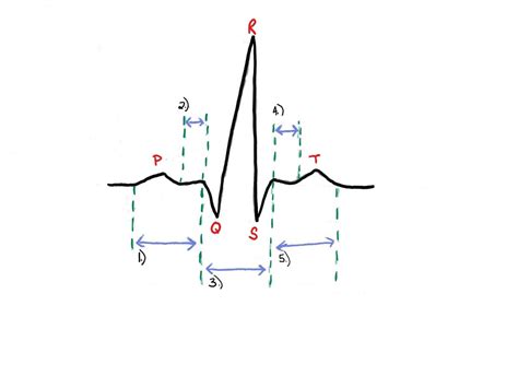 Ecg Segments Intervals Diagram Quizlet