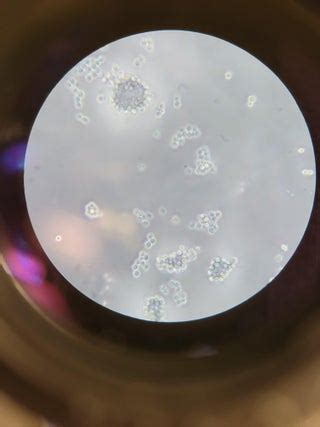 Yeast or Mold? : r/microbiology