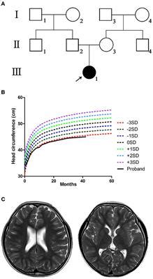 Frontiers Case Report A Novel De Novo Deletion Mutation Of Dyrk A Is