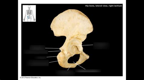 Lateral Ischium Diagram Quizlet