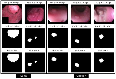 J Imaging Free Full Text Mobile Polypnet Lightweight Colon Polyp