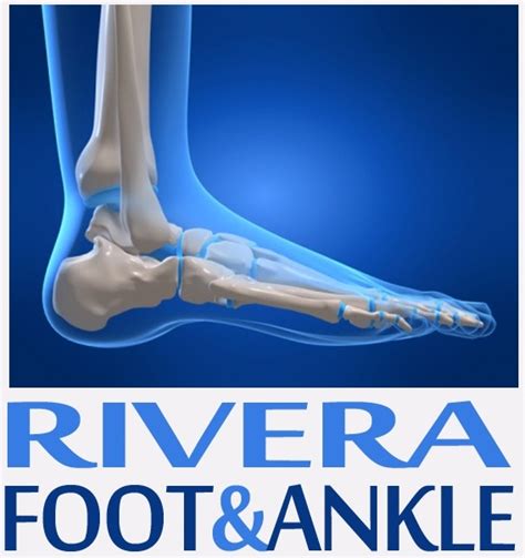 Rivera Foot And Ankle Houston Tx