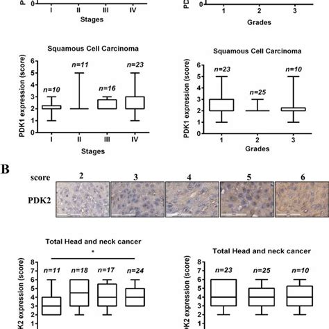 Expression Levels Of Pdk2 Were Increased In Higher Tumor Stages Of Hnc Download Scientific