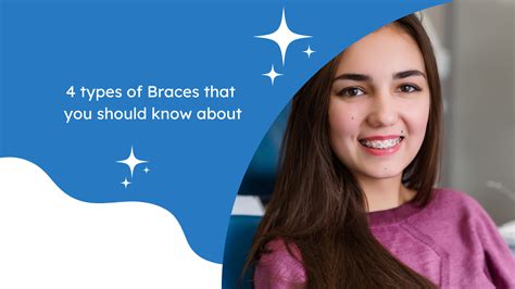 4 types of Braces that you should know about