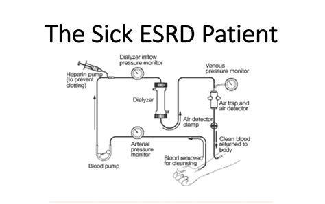 Emdocs Net Emergency Medicine Educationemdocs Cases The Sick Esrd