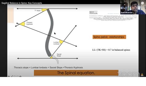 Sagittal Balance in Spine — OrthopaedicPrinciples.com