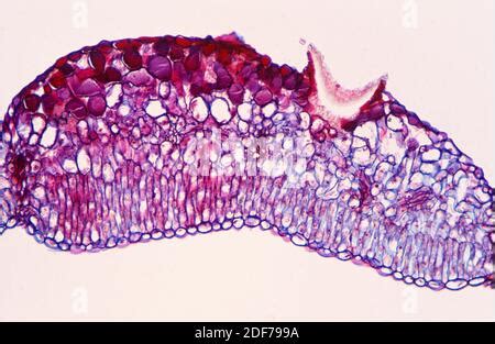 Parasitic plant fungus Puccinia microscope slide Stock Photo - Alamy