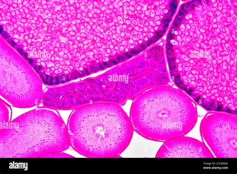 Ascaris Lumbricoides Female Showing Intestine Ovaries And Uterus With