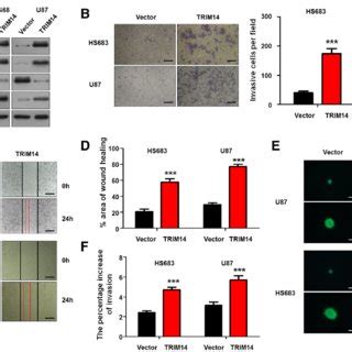 TRIM14 overexpression promotes migration/invasion in glioma cells by ... 