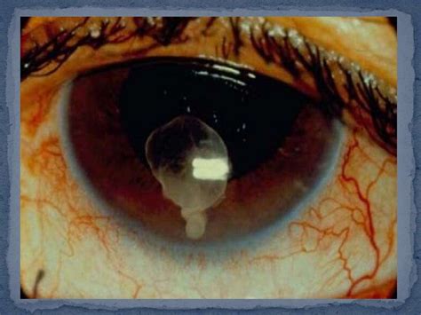 Цистицеркозы животных - презентация онлайн