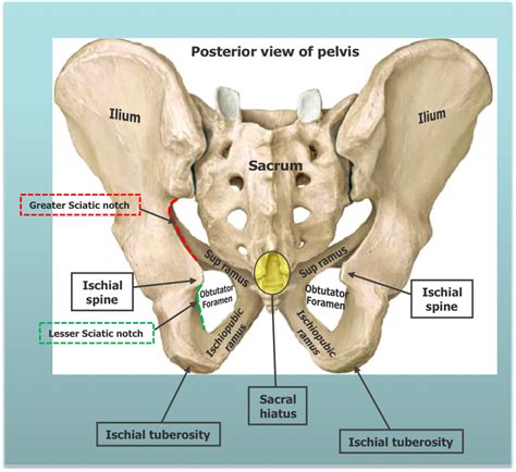 Ischiopubic Ramus