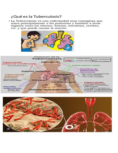 Tuberculosis Triptico Epistemologia Studocu