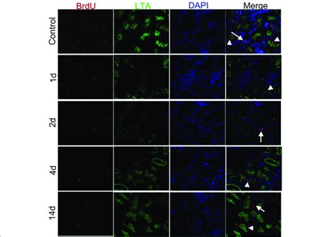 BrdU LRCs Red Co Expressed LTA Green Both In Normal And I R