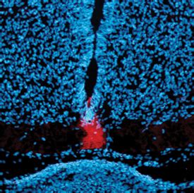 Human Mouse Patched Ptch First Extracellular Loop Antibody Mab