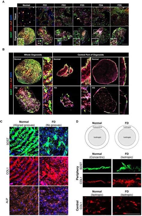 Cells Free Full Text Patient Derived Organoids Recapitulate