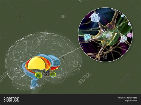 Dorsal Striatum Image & Photo (Free Trial) | Bigstock