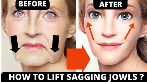 Anti Aging Face Lifting Exercises For Sagging Skin Jowls Laugh