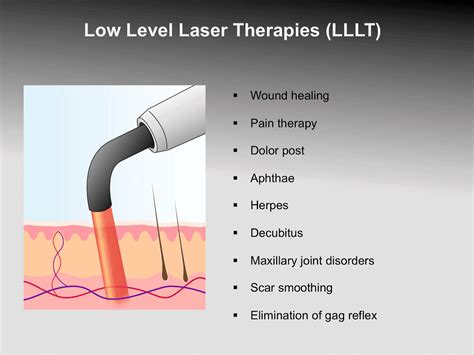 Laser teeth Treatments - Normanhurst Dental