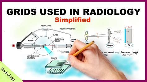 Types Of Grids In Radiography