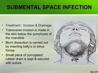 Case of space infection | PPT