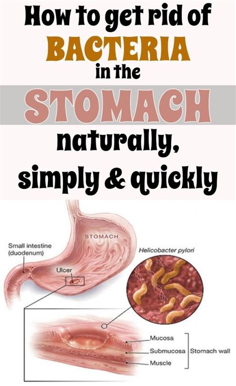 How To Get Rid Of Bacteria In The Stomach Naturally Simply And Quickly