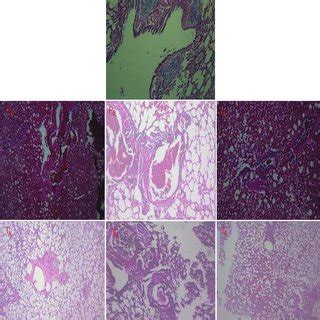 A Sample Of Photographs Of Lung Specimens In Control Group Placebo