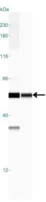 Pgdh Hpgd Antibody Nb By Novus Part Of Bio Techne