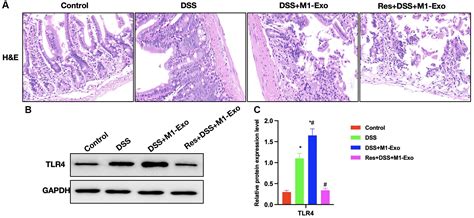 M1 Intestinal Macrophages Derived Exosomes Promote Colitis Progression And Mucosal Barrier