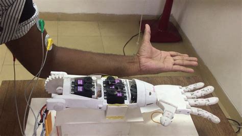 Low Cost Portable D Printed Myoelectric Prosthetic Arm Youtube