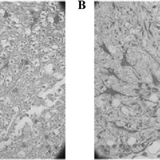 A Nse And B Gfap Expression In The Spinal Cord Of Rats In The