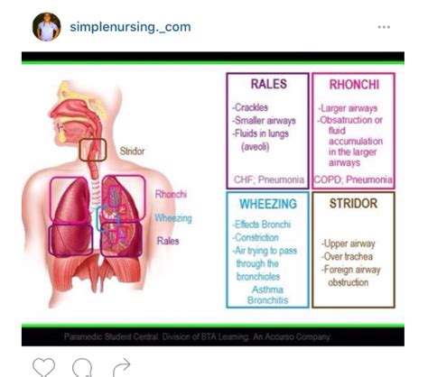 Breath sounds Respiratory Therapy, Respiratory System, Nursing Tips ...