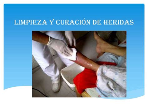 Limpieza y Curación de Heridas Valentina Mejia uDocz