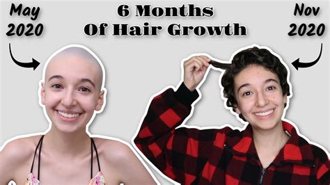 Top 137 + 6 months hair growth after shaving - polarrunningexpeditions