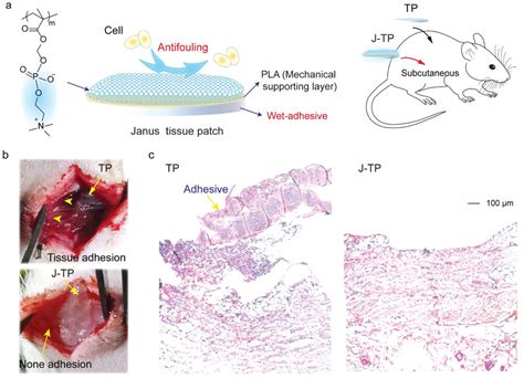 An Adhesive AntiAdhesive Janus Tissue Patch For Efficient Closure Of