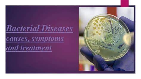 SOLUTION: Microbiology different bacterial diseases symptoms causes and ...