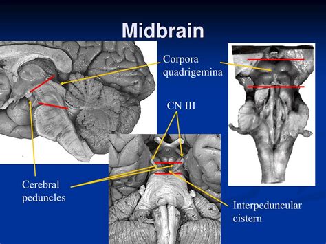 Ppt Brain Stem I Powerpoint Presentation Free Download Id628947