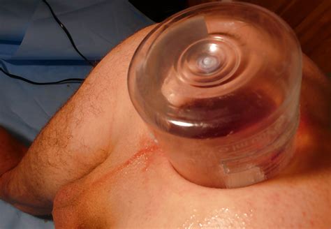 2012 01 Big Bottle In Asshole Big Peep Gaping Assfist 2 XXX Porn Album 741831