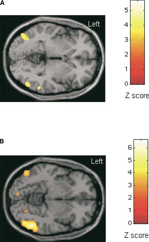 [PDF] The Human Premotor Cortex Is 'Mirror' Only for Biological Actions ...