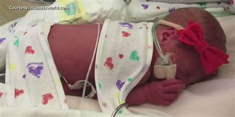 Photos First All Girl Quintuplets Born In The U S Abc7 New York