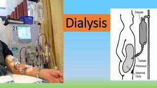 Chetan Dialysis Ppt PPT