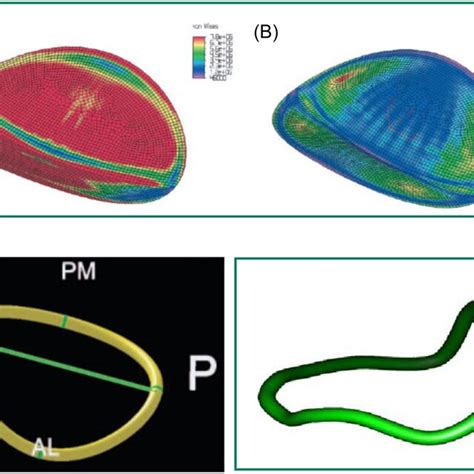 Saddle Shape Annulus Permits Normal Stress On The Leaflets Flat