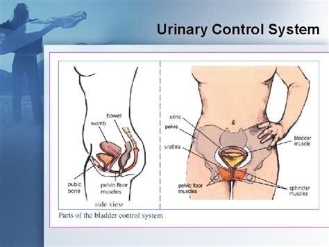 INTERSTIM THERAPY For Urinary Control What Are Bladder