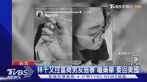 林千又控富商男友施暴 曬藥單認精神有問題「要回美國」｜tvbs新聞 Tvbsnews01 Youtube