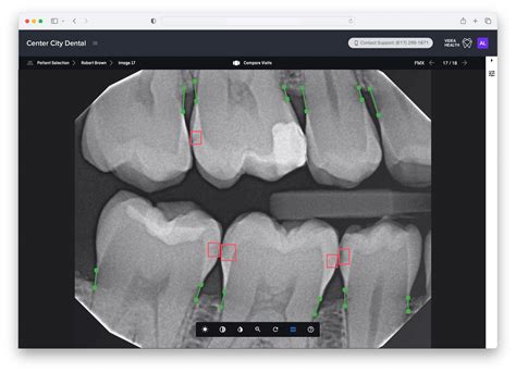 Dental Ai For Practices Videahealth