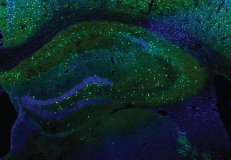 NIH study in mice provides insight into how brain activity is fine ...
