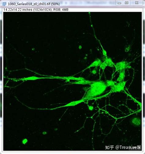 Imagej实用技巧——平均荧光强度检测定量分析篇 知乎