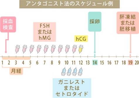 体外受精ivf時の採卵から移植までのスケジュールは？治療の流れを解説 にしたんartクリニック